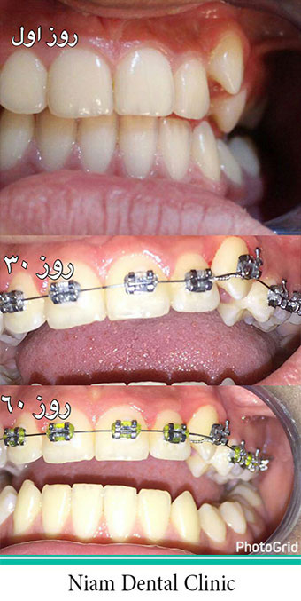 ارتودنسی دندان