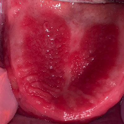 بیماری دهان