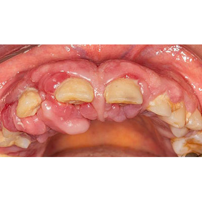 بیماری دهان